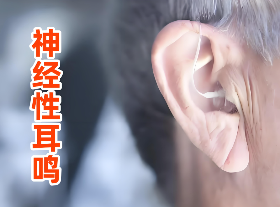 神经性耳鸣吃什么药效果最好最快？2025神经性耳鸣药物治疗全面指南：从传统药物到前沿创新方案