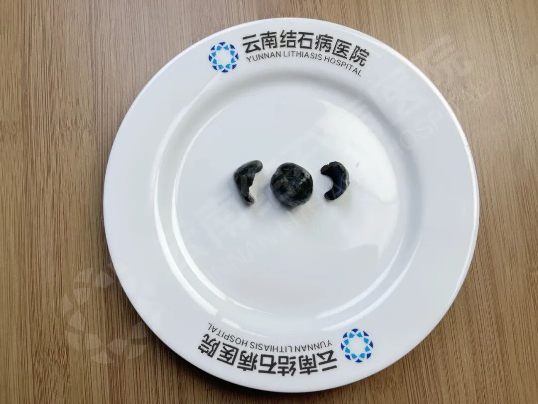 a2a42138ly4idteyyernrj20u00miwgy.jpg